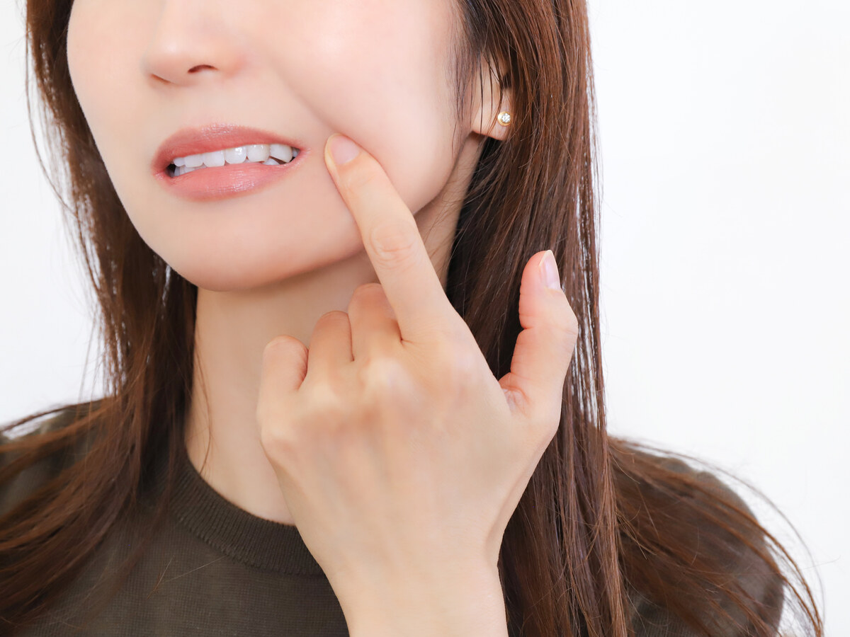 歯周病治療のイメージ
